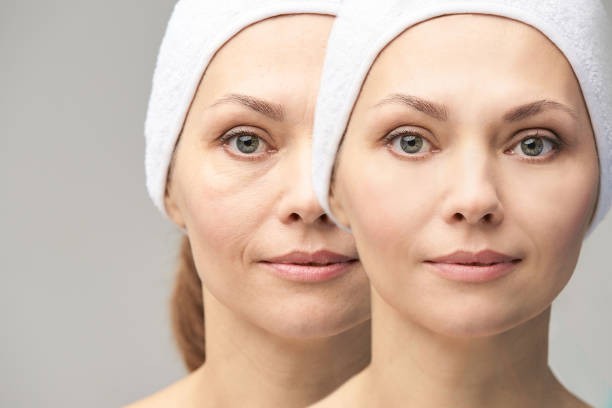 NCTF 135HA: Den ultimata behandlingen mot åldrande hud